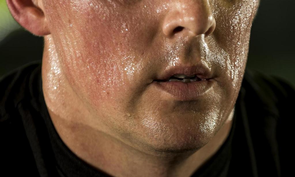 Excessive Sweating (Hyperhidrosis)
