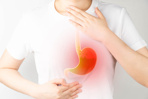 Acid Reflux, GERD & Heartburn